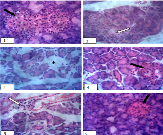 Photomicrograph of the pancreas histology.